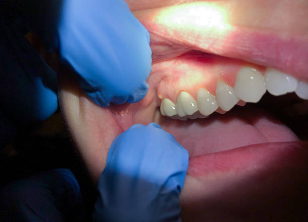 Best Cracked Tooth Emergency Dentist  in Westminster, TX